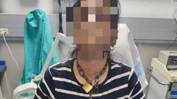 HISZPANIA: brutalnie pobita kobieta z łańcuchem na szyi trafiła do szpitala